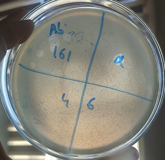 Acinetobacter baumannii bacteriophage 120161D