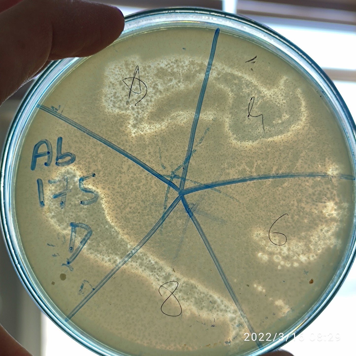 Acinetobacter baumannii bacteriophage 120175D