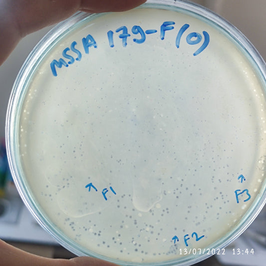 Staphylococcus aureus bacteriophage 152179F