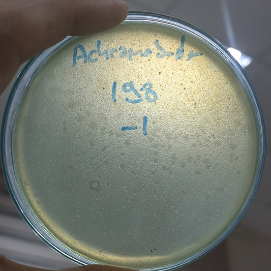 Achromobacter xylosoxidans bacteriophage 200198D