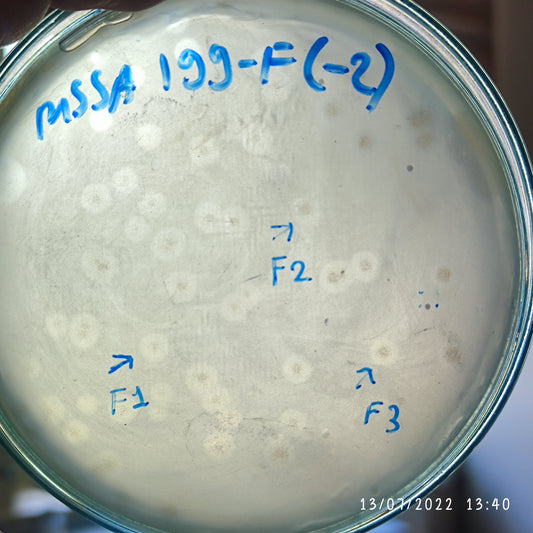 Staphylococcus aureus bacteriophage 152199F