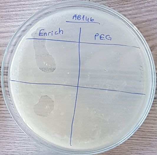 Acinetobacter baumannii bacteriophage 120146A