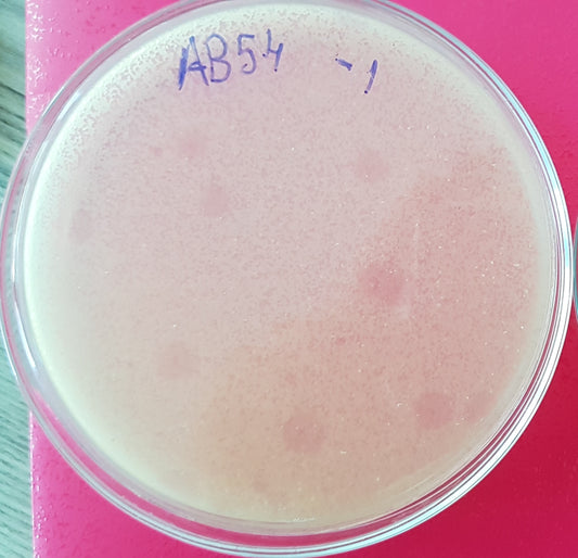 Acinetobacter baumannii bacteriophage 120054A