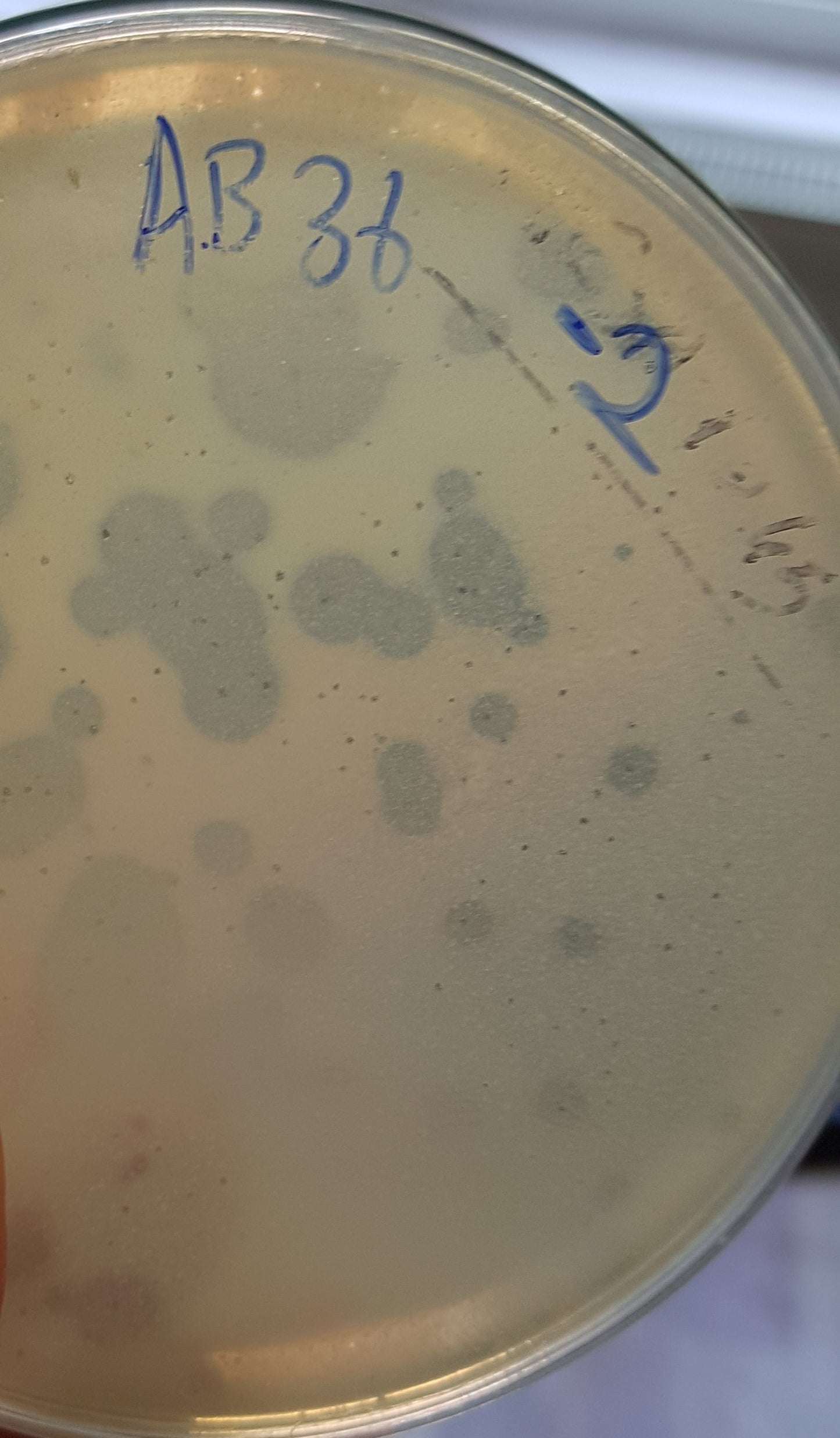 Acinetobacter baumannii bacteriophage 120036A
