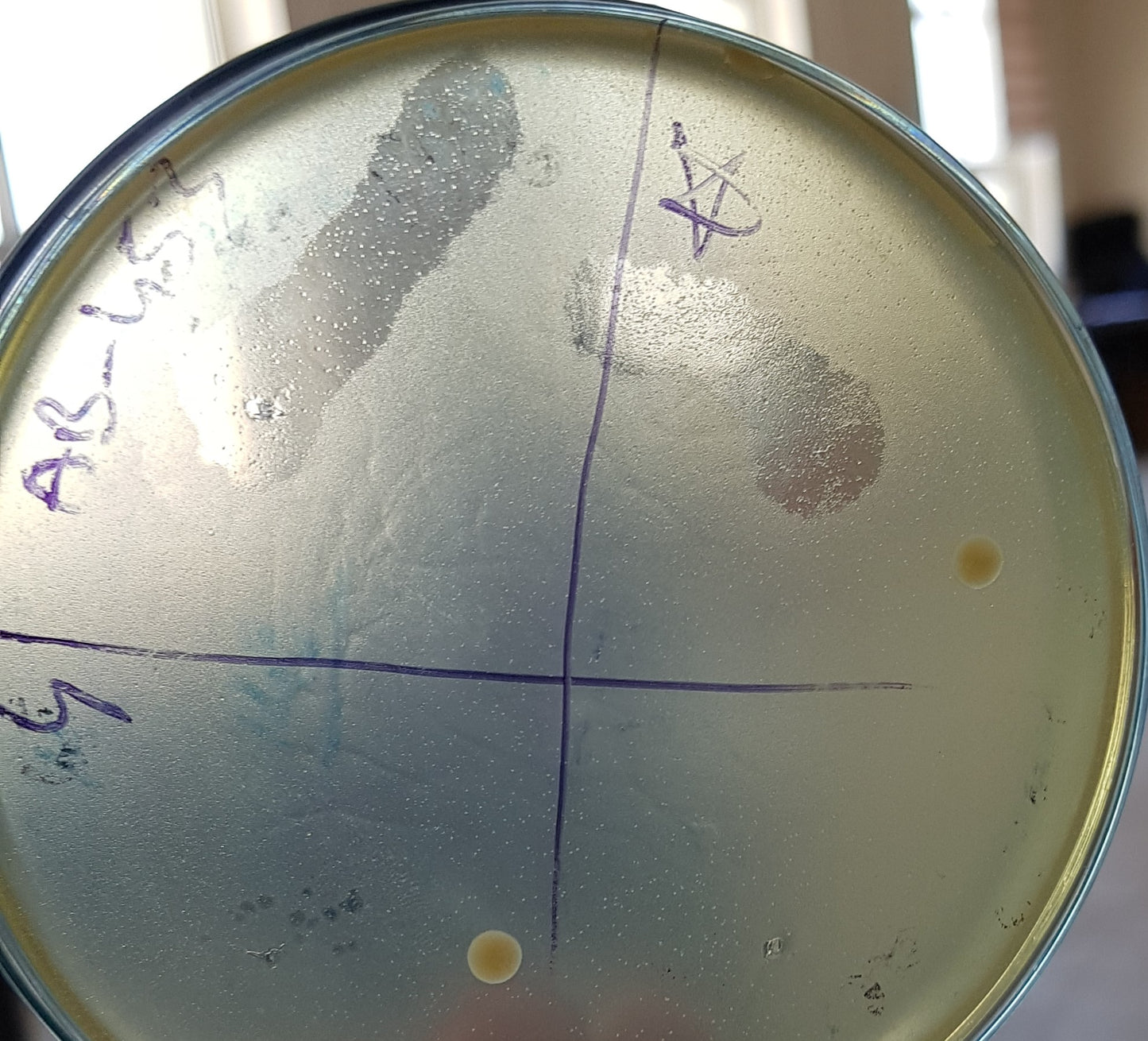 Acinetobacter baumannii bacteriophage 120453C