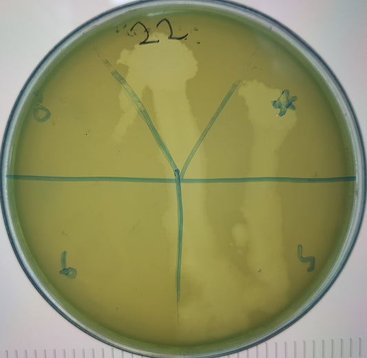 Pseudomonas aeruginosa bacteriophage 130022A