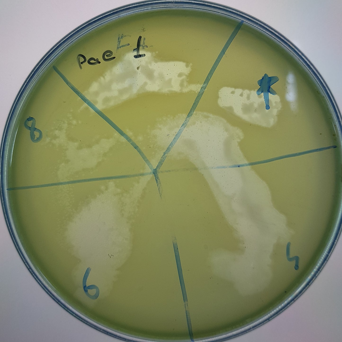 Pseudomonas aeruginosa bacteriophage 130001A