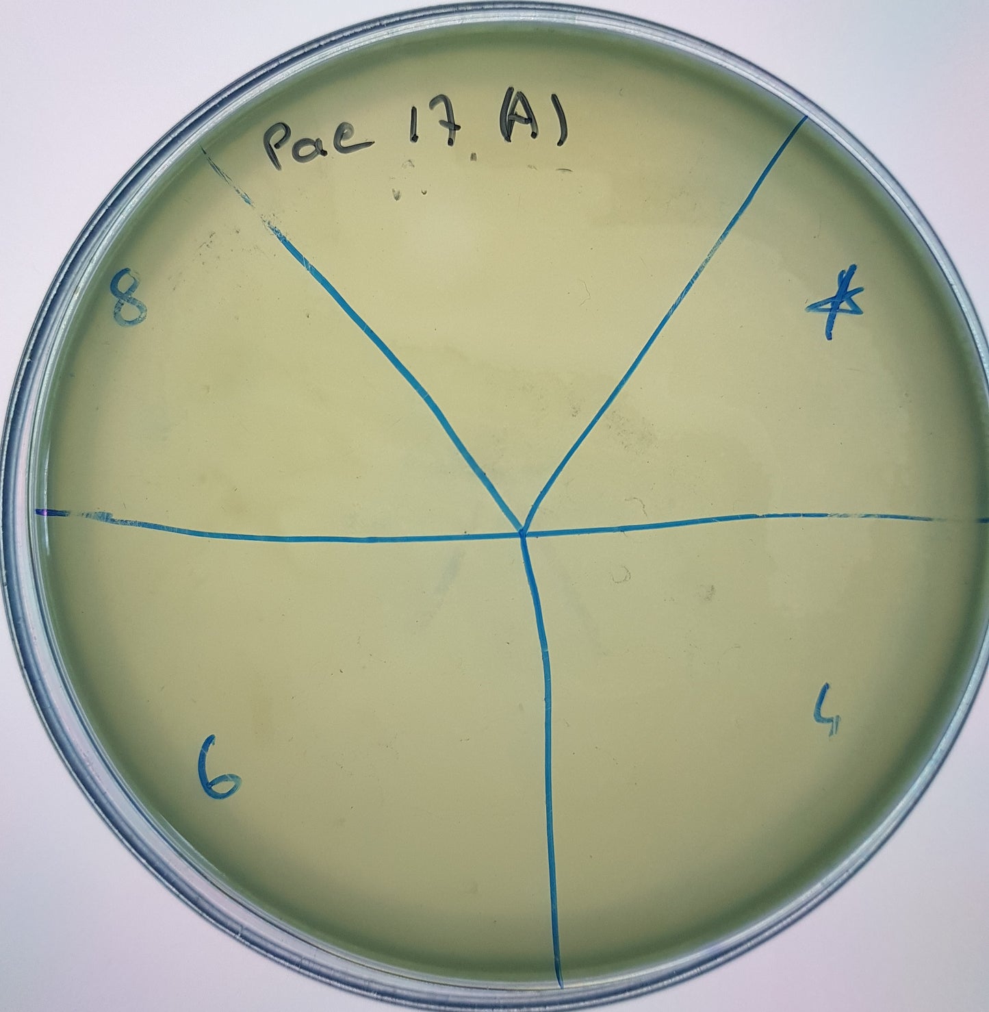 Pseudomonas aeruginosa bacteriophage 130017A