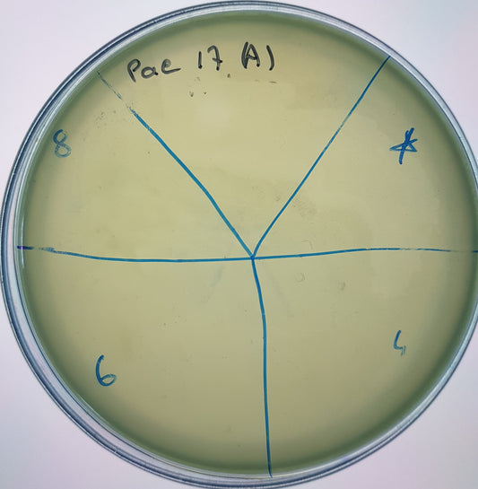 Pseudomonas aeruginosa bacteriophage 130017A