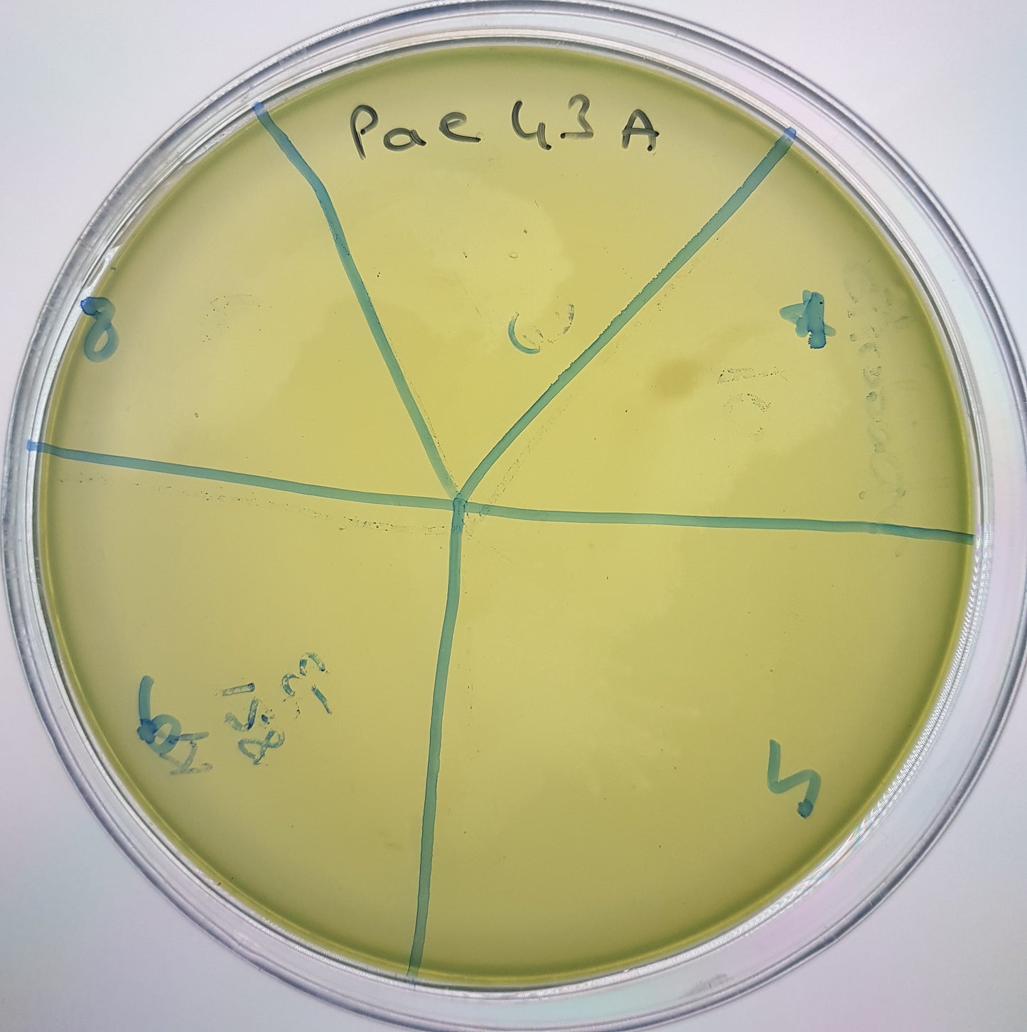 Pseudomonas aeruginosa bacteriophage 130043A