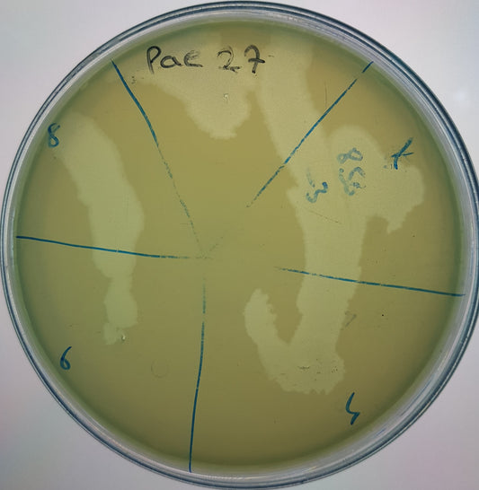 Pseudomonas aeruginosa bacteriophage 130027A