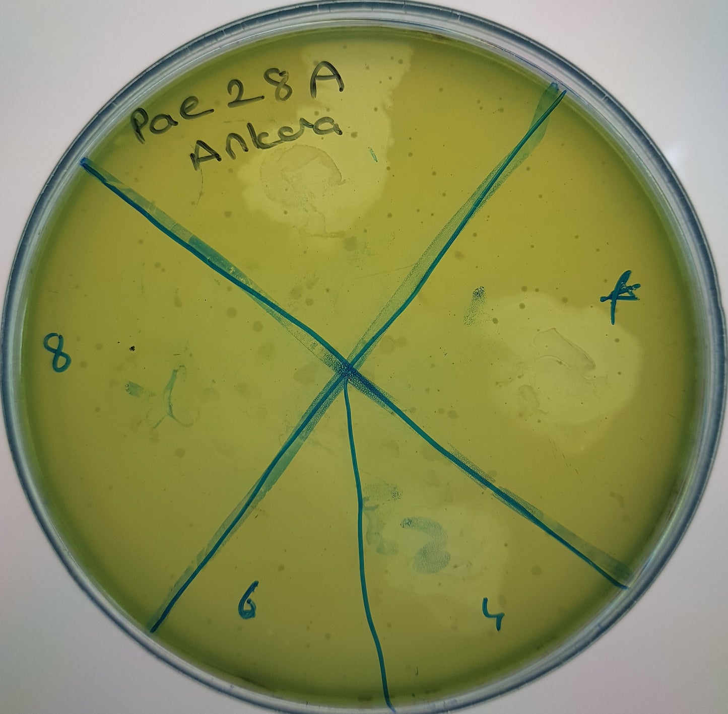 Pseudomonas aeruginosa bacteriophage 130028A