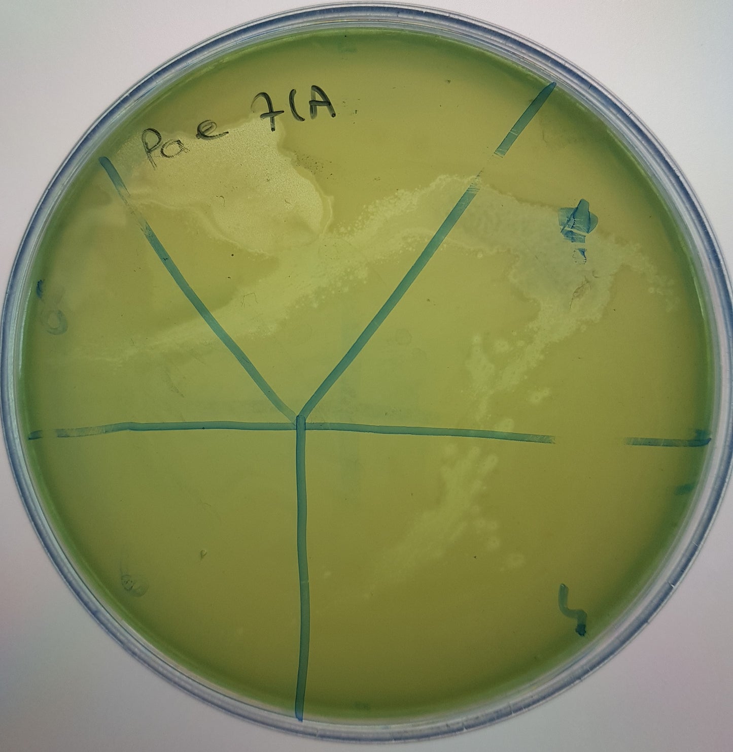 Pseudomonas aeruginosa bacteriophage 130071A