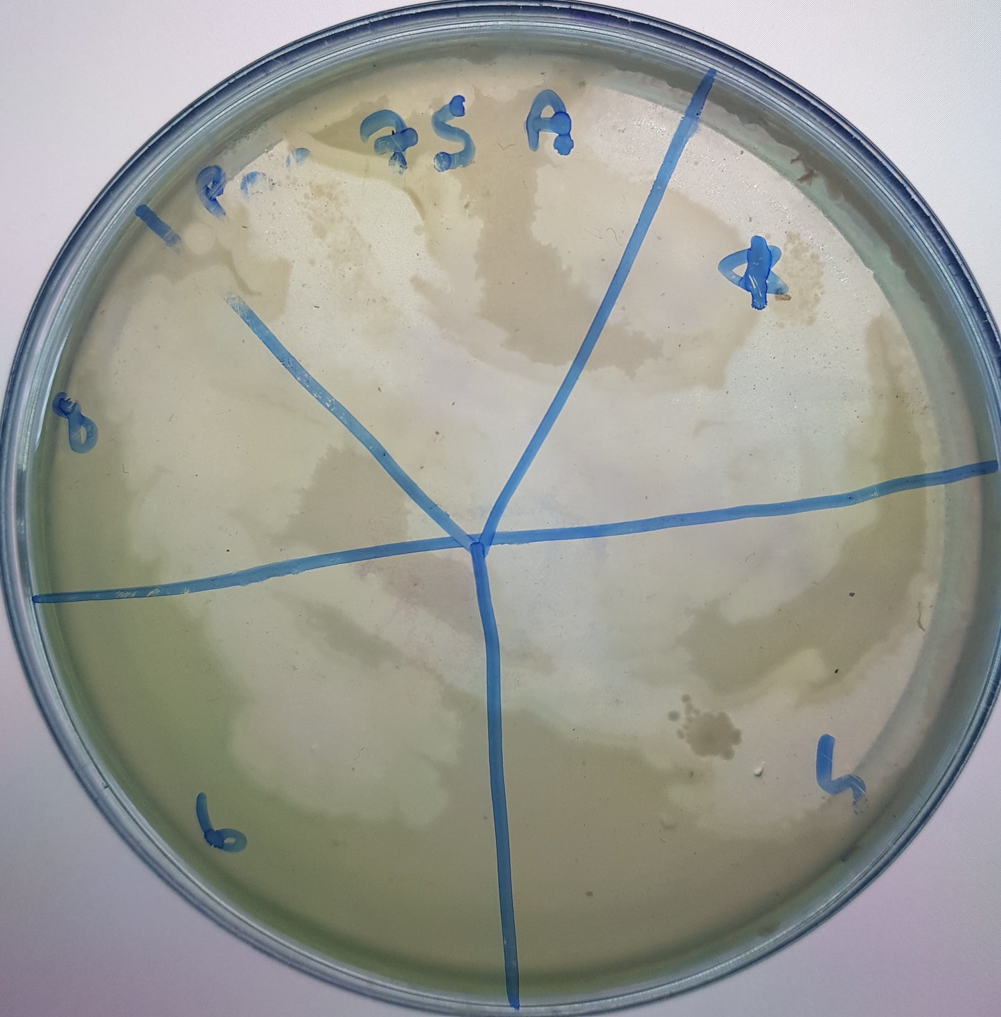 Pseudomonas aeruginosa bacteriophage 130075A