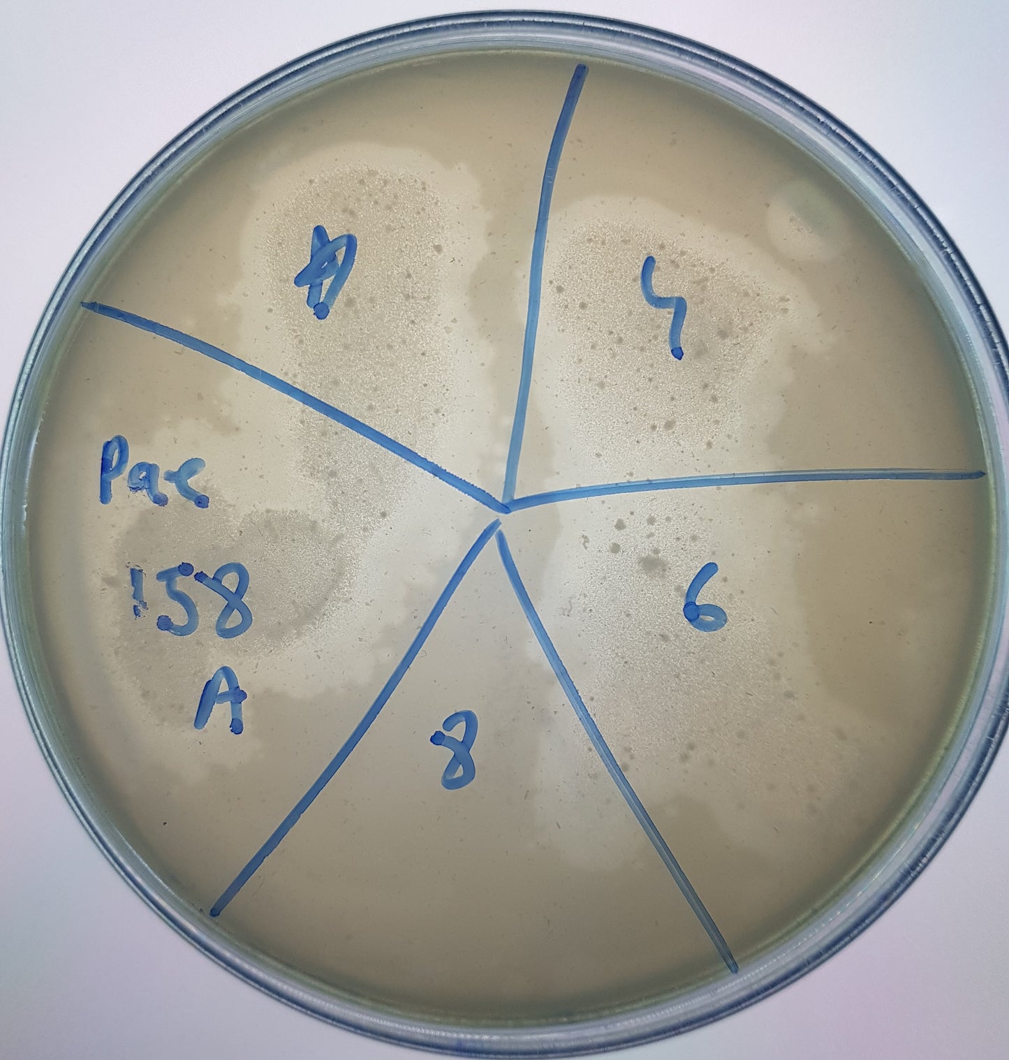 Pseudomonas aeruginosa bacteriophage 130158A