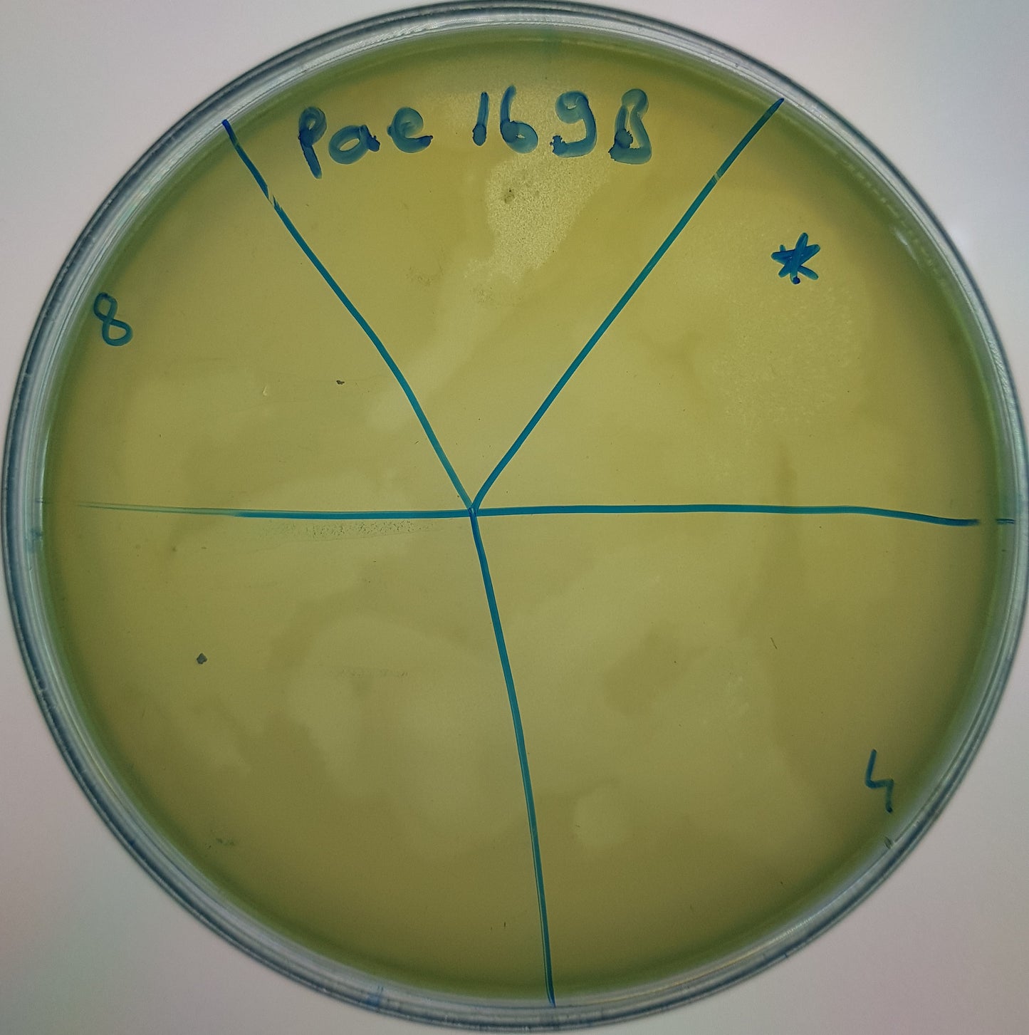 Pseudomonas aeruginosa bacteriophage 130169B