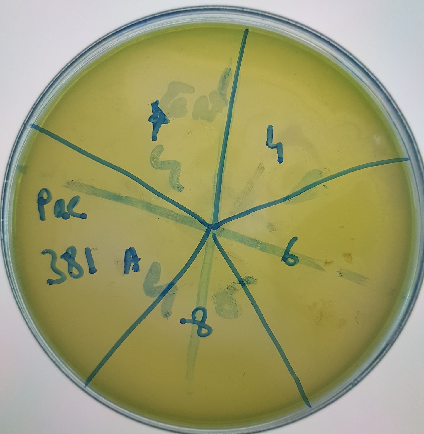 Pseudomonas aeruginosa bacteriophage 130381A