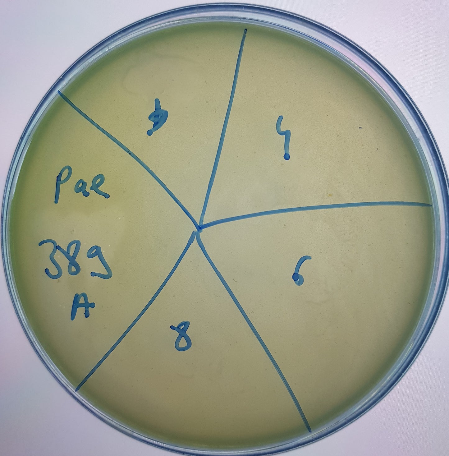 Pseudomonas aeruginosa bacteriophage 130389A