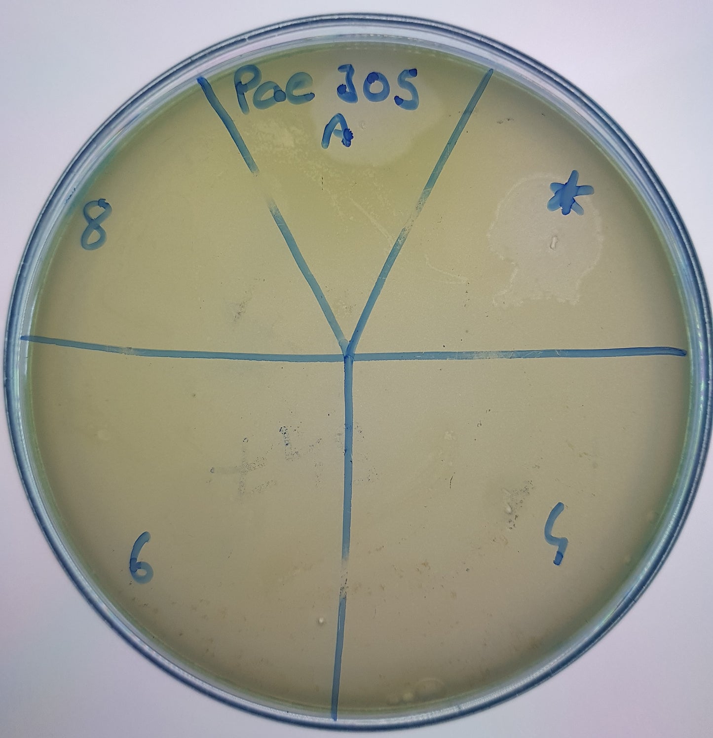 Pseudomonas aeruginosa bacteriophage 130305A