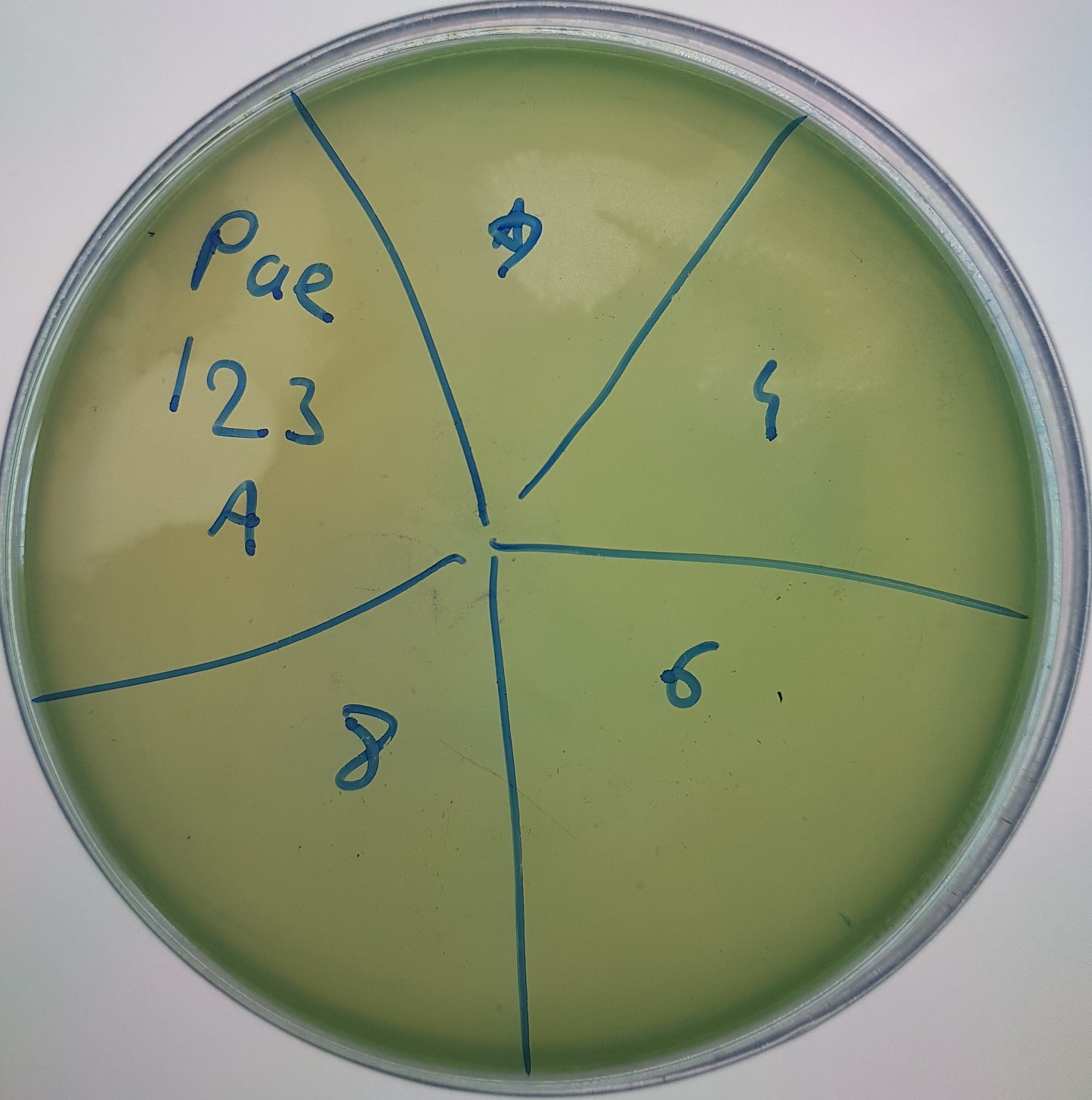 Pseudomonas aeruginosa bacteriophage 130123A
