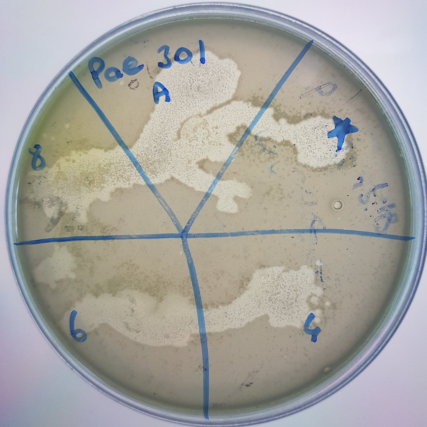 Pseudomonas aeruginosa bacteriophage 130301A