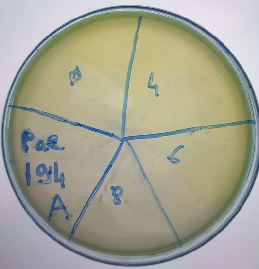Pseudomonas aeruginosa bacteriophage 130194A