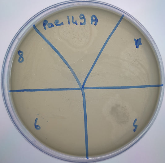 Pseudomonas aeruginosa bacteriophage 130149A