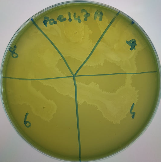 Pseudomonas aeruginosa bacteriophage 130147A