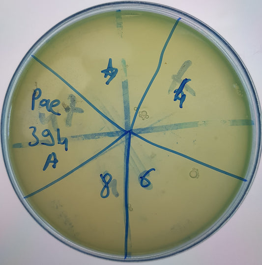 Pseudomonas aeruginosa bacteriophage 130394A