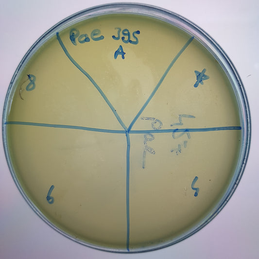 Pseudomonas aeruginosa bacteriophage 130395A