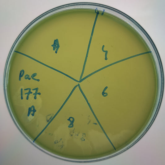 Pseudomonas aeruginosa bacteriophage 130177A