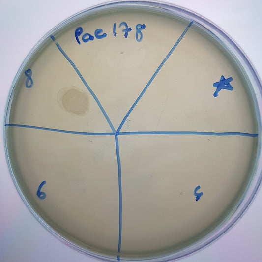 Pseudomonas aeruginosa bacteriophage 130178A