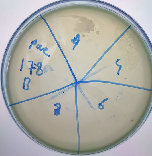 Pseudomonas aeruginosa bacteriophage 130178B