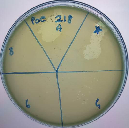 Pseudomonas aeruginosa bacteriophage 130218A