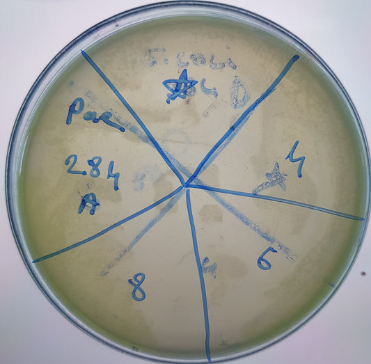 Pseudomonas aeruginosa bacteriophage 130284A