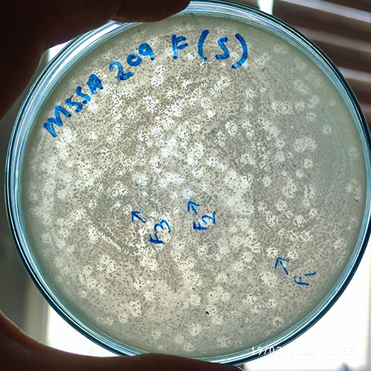 Staphylococcus aureus bacteriophage 152209F
