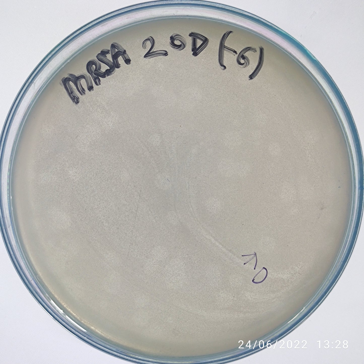 Staphylococcus aureus bacteriophage 150020D