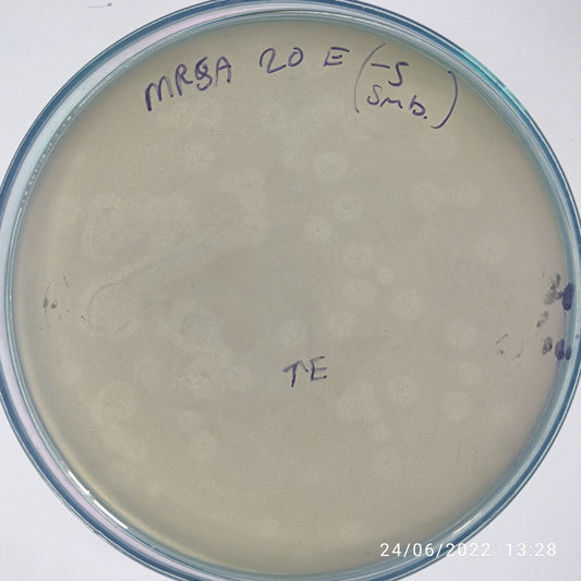 Staphylococcus aureus bacteriophage 150020E