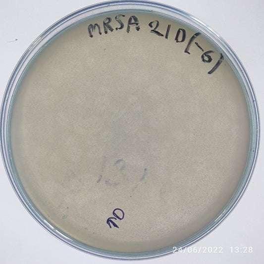 Staphylococcus aureus bacteriophage 150021D