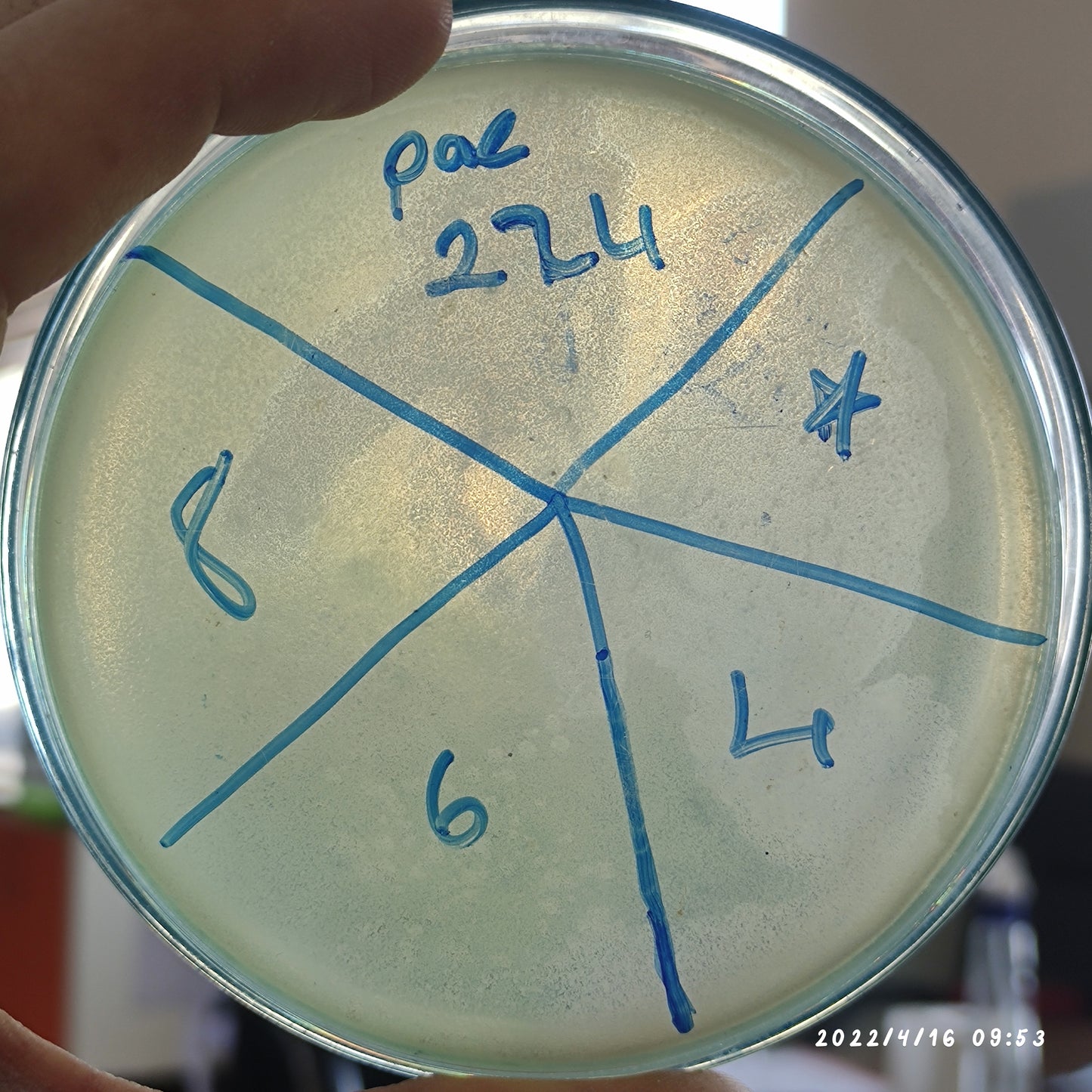 Pseudomonas aeruginosa bacteriophage 130224D