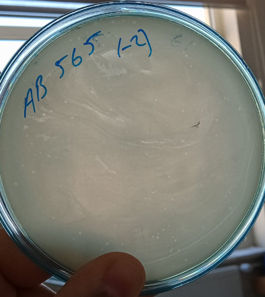 Acinetobacter baumannii bacteriophage 120565A