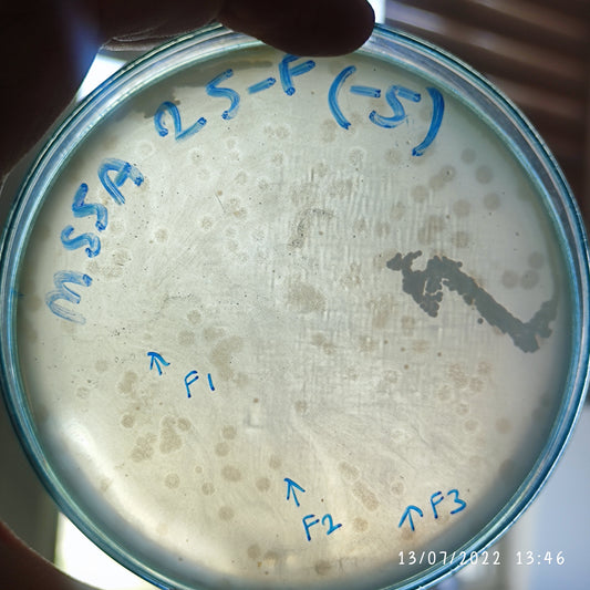 Staphylococcus aureus bacteriophage 152025F