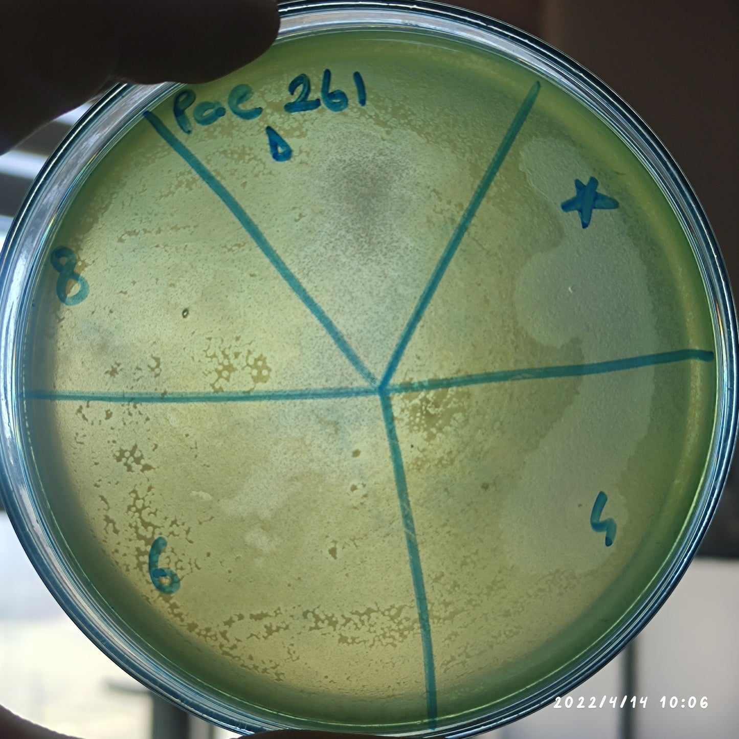 Pseudomonas aeruginosa bacteriophage 130261D