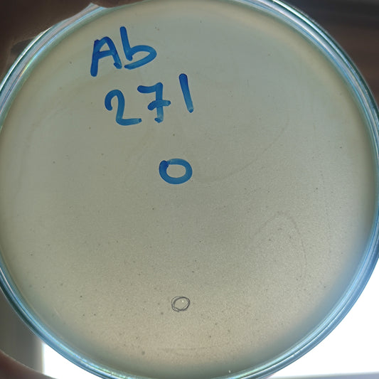 Acinetobacter baumannii bacteriophage 120271A