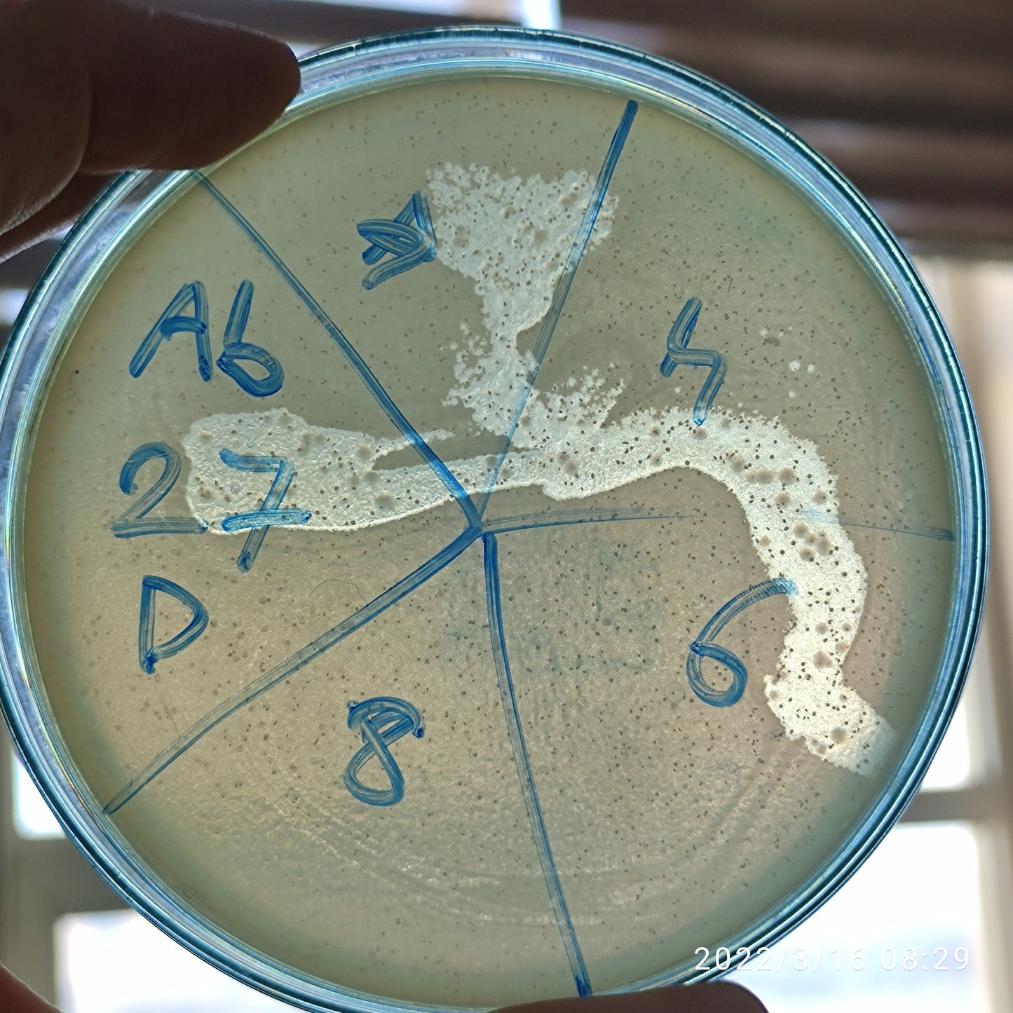 Acinetobacter baumannii bacteriophage 120027D