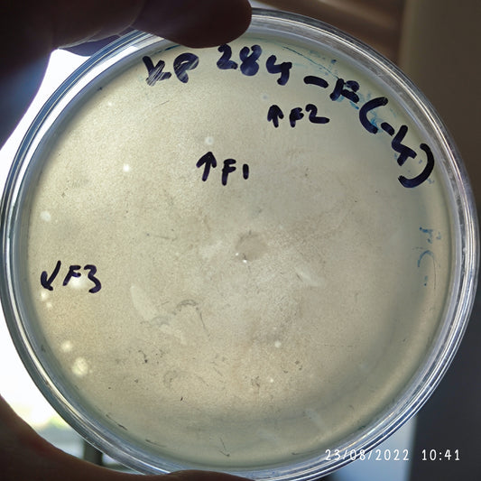 Klebsiella pneumoniae bacteriophage 180284F