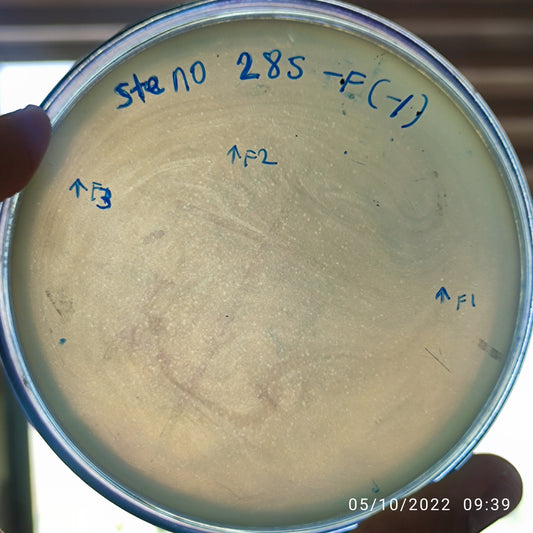Stenotrophomonas maltophilia bacteriophage 200285F
