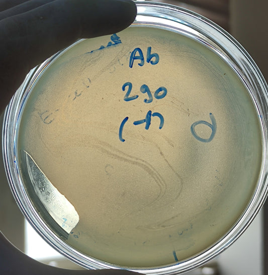 Acinetobacter baumannii bacteriophage 120290A