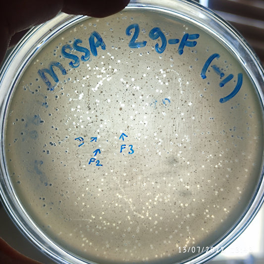 Staphylococcus aureus bacteriophage 152029F