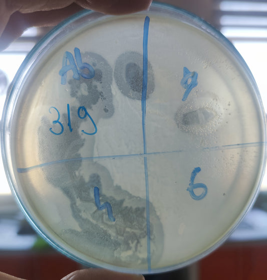 Acinetobacter baumannii bacteriophage 120319A
